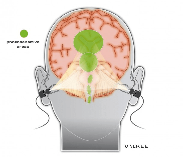 Stark et al. (2012) e la stimolazione intrauricolare.